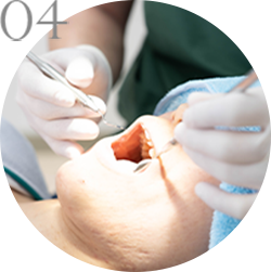 松本市の歯医者、平林歯科医院の訪問歯科の流れ